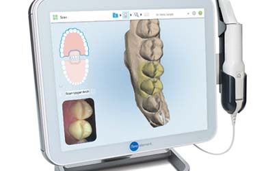 口腔内３Dスキャナー「iTero element」